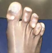 Guaina Digitale Elastica Liscia in Silicone S029 - immagine 3