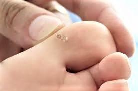 Guaina Digitale Elastica Liscia in Silicone S029 - immagine 5