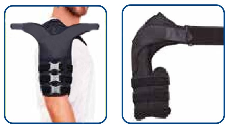 Art. Humerux - immagine 4